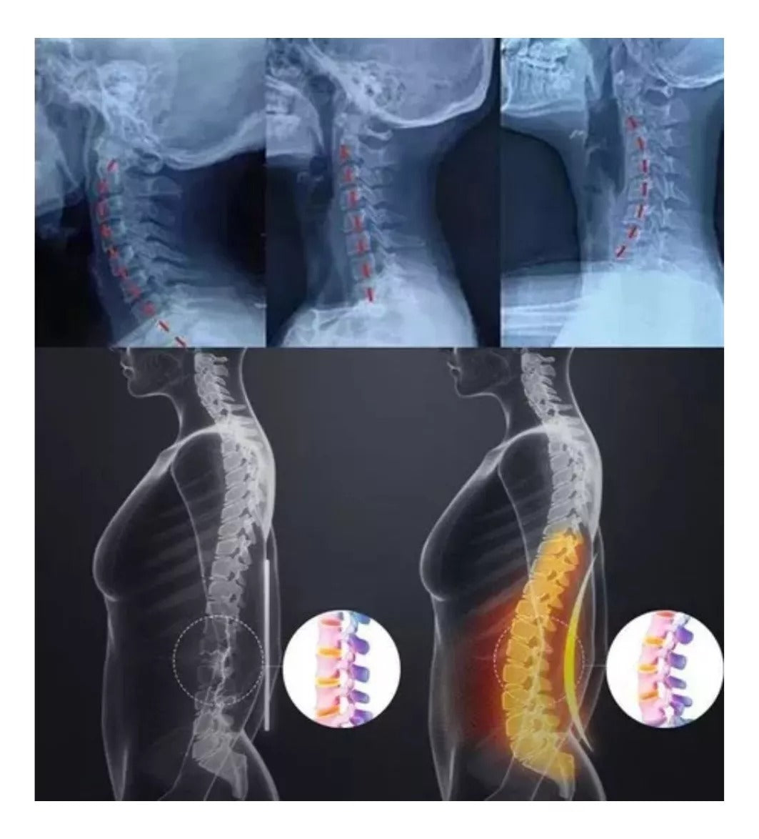 Soporte Lumbar Almohada Cervical - te libera del dolor - ULTIMAS UNIDADES 🔥